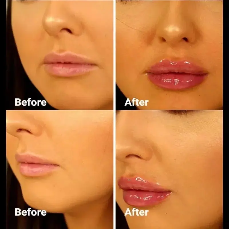 Instant Filler Lip Plumper (3ml)