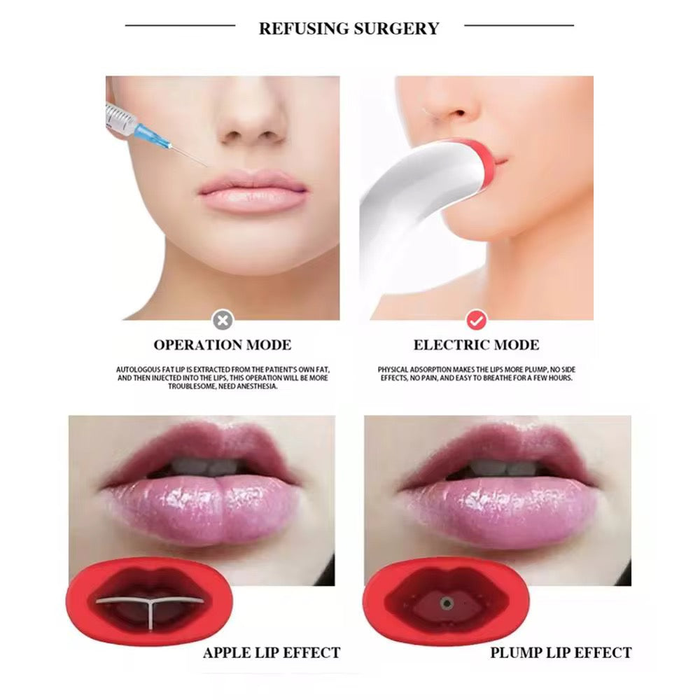 Automatic Lip Plumper Device