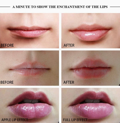 Automatic Lip Plumper Device