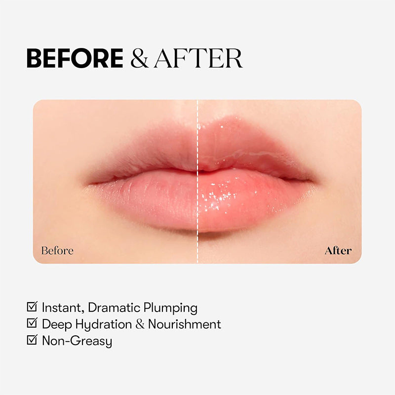Micro-needle Filler Lip Plumper (3ml)