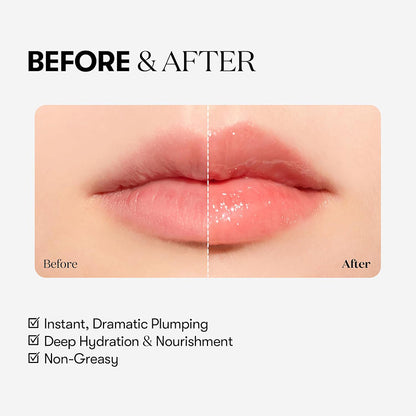 Micro-needle Filler Lip Plumper (3ml)